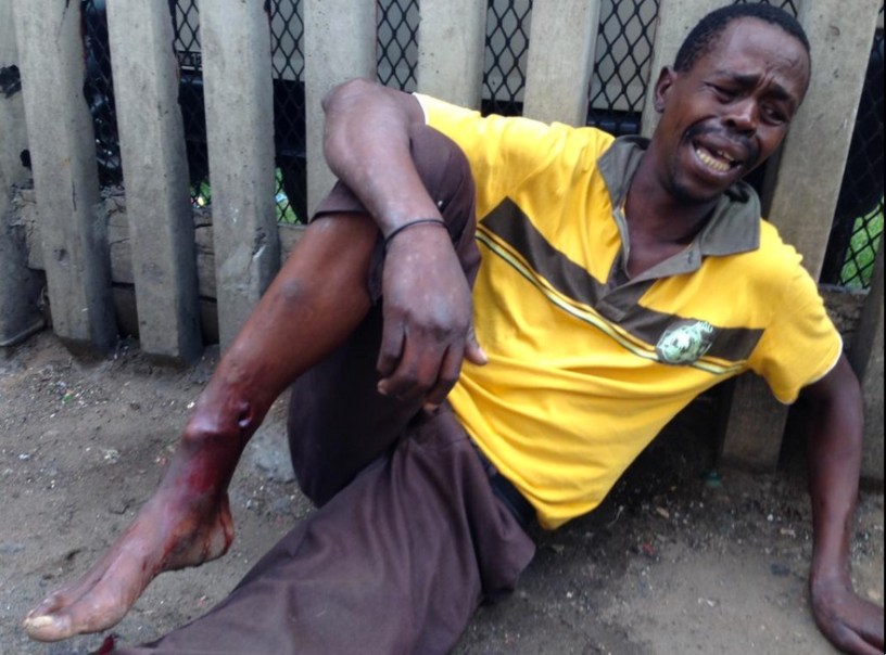 Xenophobic attack Durban