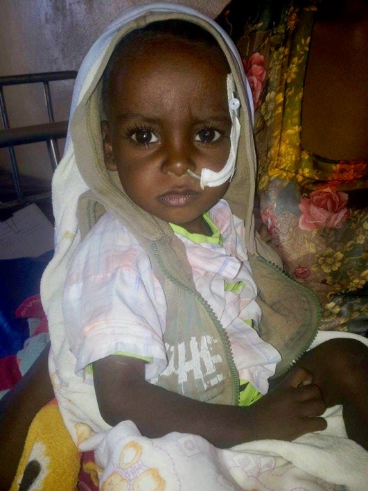 Eritrea drought, malnutrition and cholera