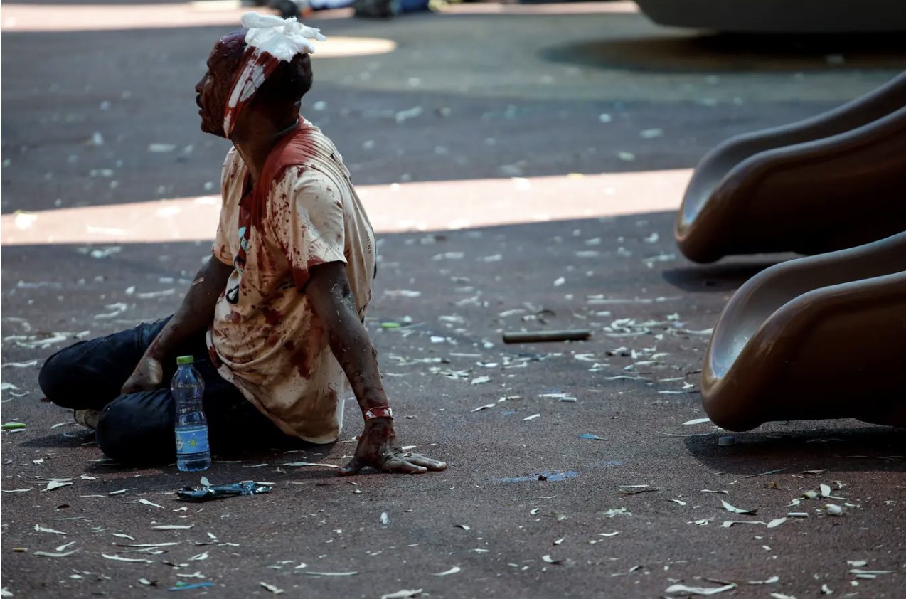 Eritrean protester injured during protests in Tel Aviv against PFDJ Festival