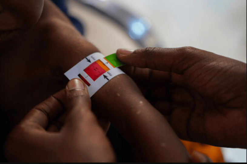 Malnutrition measured Somalia, Baidoa